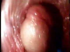 VidsPlus presents: Video from the inside of a vagina... very interesting